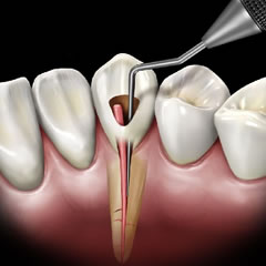 Conservative & Endodontics