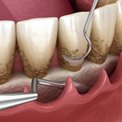 Periodontics