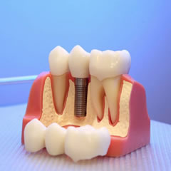 Prosthodontics