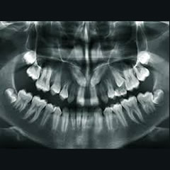 Oral Medicine & Radiology